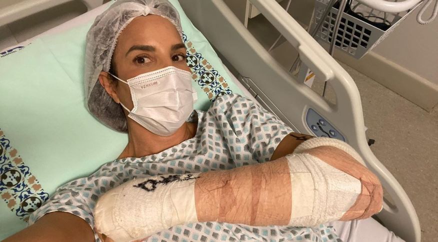 Ivete Sangalo tranquiliza fãs e amigos após cirurgia no braço; cantora caiu no Chile  