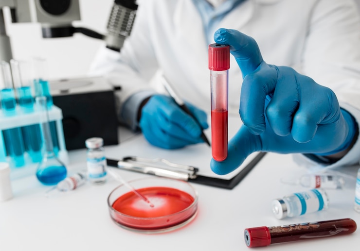 Cientistas descobrem exame de sangue que pode detectar o câncer de pâncreas